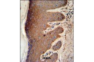 PKM2 Antibody (C-term L398) IHC analysis in formalin fixed and paraffin embedded skin tissue followed by peroxidase conjugation of the secondary antibody and DAB staining. (PKM2 抗体  (C-Term))