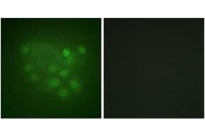 Immunofluorescence analysis of A549 cells, using KIF2C (Ab-95) Antibody. (KIF2C 抗体  (AA 61-110))