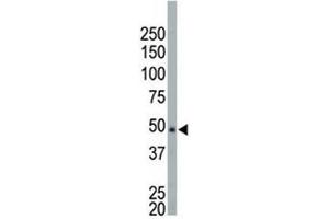 NEK2 antibody used in western blot to detect NEK2 in HeLa cell lysate (NEK2 抗体  (AA 350-382))
