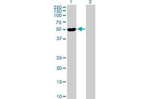 Western Blot analysis of POLR1E expression in transfected 293T cell line by POLR1E MaxPab polyclonal antibody. (POLR1E 抗体  (AA 1-419))