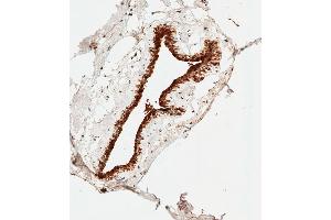 Immunohistochemistry (Paraffin-embedded Sections) (IHC (p)) image for anti-S100 Calcium Binding Protein B (S100B) antibody (ABIN651265)