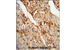 MYOZ1 Antibody (Center) (ABIN651441 and ABIN2840243) immunohistochemistry analysis in formalin fixed and paraffin embedded mouse heart tissue followed by peroxidase conjugation of the secondary antibody and DAB staining. (Myozenin 1 抗体  (AA 40-69))