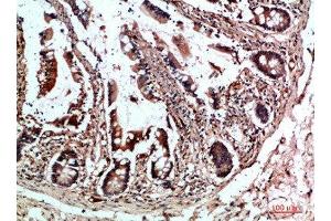 Immunohistochemical analysis of paraffin-embedded human-colon, antibody was diluted at 1:200 (CYFIP2 抗体  (AA 1171-1220))