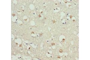 Immunohistochemistry of paraffin-embedded human brain tissue using ABIN7154698 at dilution of 1:100 (GNAO1 抗体  (AA 60-180))