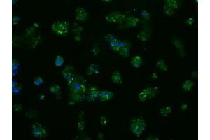 Image no. 10 for anti-Amyloid beta (A4) Precursor Protein (APP) antibody (ABIN1496877) (APP 抗体)