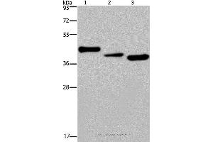 Western blot analysis of Mouse heart tissue, A549 and HepG2 cell, using CYR61 Polyclonal Antibody at dilution of 1:300 (CYR61 抗体)