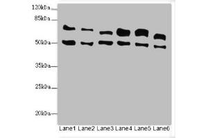 Western blot All lanes: ELF2 antibody at 3. (ELF2 抗体  (AA 1-140))