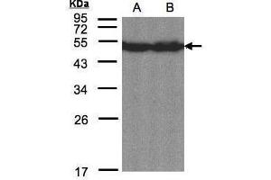 WB Image Sample(30 μg of whole cell lysate) A:Hep G2, B:MOLT4 , 12% SDS PAGE antibody diluted at 1:1500 (CREB3L1 抗体  (C-Term))
