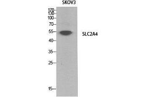 Western Blot (WB) analysis of SKOV3 cells using Glut4 Polyclonal Antibody. (GLUT4 抗体  (Internal Region))