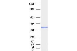 Western Blotting (WB) image for Aldolase B, Fructose-Bisphosphate (ALDOB) protein (Myc-DYKDDDDK Tag) (ABIN2714559)