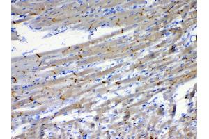 Immunohistochemistry (IHC) image for anti-Catenin (Cadherin-Associated Protein), beta 1, 88kDa (CTNNB1) (AA 2-233) antibody (ABIN5518980)