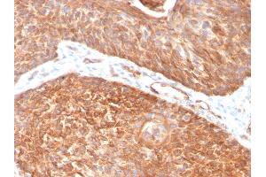 Formalin-fixed, paraffin-embedded human Pancreas stained with Cytokeratin 5 Mouse Monoclonal Antibody (KRT5/3594). (Cytokeratin 5 抗体  (AA 316-590))