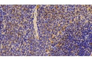 Immunohistochemistry (IHC) image for anti-Complement Fragment 3a (C3a) (AA 671-748) antibody (ABIN7439093)