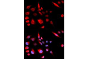 Immunofluorescence (IF) image for anti-Kinesin Family Member 2C (KIF2C) antibody (ABIN1876637) (KIF2C 抗体)