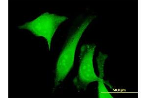 Immunofluorescence of purified MaxPab antibody to CALU on HeLa cell. (CALU 抗体  (AA 1-315))