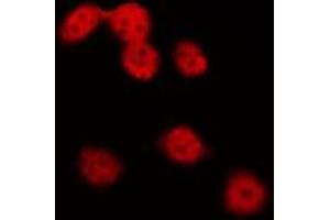 ABIN6275731 staining Hela by IF/ICC. (NKX2-8 抗体  (N-Term))