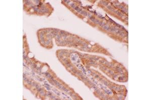 Anti-NFkB p100 Picoband antibody,  IHC(P): Mouse Intestine Tissue