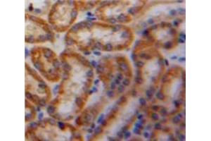 Used in DAB staining on fromalin fixed paraffin-embedded Kidney tissue (PDGF-AA Homodimer (AA 90-190) 抗体)
