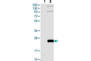 Western blot analysis of Lane 1: Negative control (vector only transfected HEK293T lysate). (WW Domain Binding Protein 5 (WBP5) 抗体)