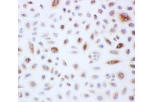 Peroxiredoxin 3 antibody and A549 cells tested by ICC (Peroxiredoxin 3 抗体  (AA 239-256))
