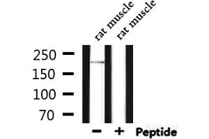 Western blot analysis of extracts from rat muscle, using DOCK7 Antibody. (DOCK7 抗体  (N-Term))