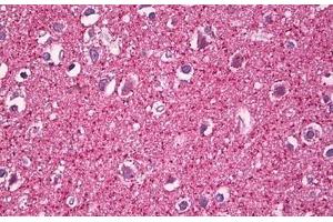 Anti-MZF1 antibody IHC staining of human brain, cortex neuropil. (MZF1 抗体  (AA 1-50))