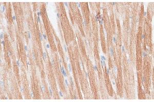 Immunohistochemistry of paraffin-embedded Mouse heart using GRK5 Polyclonal Antibody at dilution of 1:100 (40x lens). (GRK5 抗体)