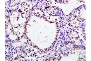 Formalin-fixed and paraffin embedded rat lung labeled with Anti-phospho-DAXX (Ser495) Polyclonal Antibody, Unconjugated (ABIN757672) at 1:200 followed by conjugation to the secondary antibody (DAXX 抗体  (pSer495))