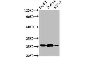 Western Blot  Positive WB detected in:HepG2 whole cell lysate,Jurkat whole cell lysate,MCF-7 whole cell lysate  All lanes:BCL2 antibody at 1μg/ml  Secondary  Goat polyclonal to rabbit IgG at 1/50000 dilution  Predicted band size: 26 KDa  Observed band size: 26 KDa (Recombinant Bcl-2 抗体)