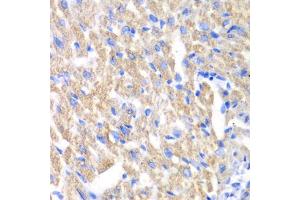 Immunohistochemistry of paraffin-embedded mouse heart using CREB3 antibody (ABIN6291021) at dilution of 1:100 (40x lens). (CREB3 抗体)