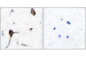 Immunohistochemistry analysis of paraffin-embedded human brain tissue, using IL-3R beta (Ab-593) Antibody. (CSF2RB2 抗体  (AA 559-608))