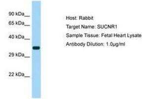 Image no. 1 for anti-Succinate Receptor 1 (SUCNR1) (AA 161-210) antibody (ABIN6750142) (SUCNR1 抗体  (AA 161-210))