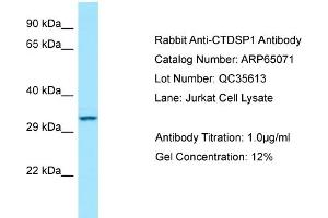 Western Blotting (WB) image for anti-CTD (Carboxy-terminal Domain, RNA Polymerase II, Polypeptide A) Small Phosphatase 1 (CTDSP1) (N-Term) antibody (ABIN2774415) (CTDSP1 抗体  (N-Term))