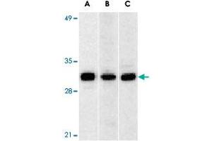Western blot analysis of ANP32A expression in human Raji cell (A), mouse (B) and rat (C) testis tissue llysates with ANP32A polyclonal antibody  at 1 ug/mL . (PHAP1 抗体  (C-Term))