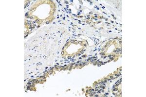 Immunohistochemistry of paraffin-embedded human prostate using STXBP2 antibody (ABIN5975753) at dilution of 1/100 (40x lens). (STXBP2 抗体)