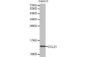 Western blot analysis of extracts of Caco-2 cell lysate, using CCL21 antibody. (CCL21 抗体  (AA 24-134))