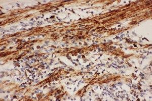 Immunohistochemistry (IHC) image for anti-Prostaglandin-Endoperoxide Synthase 1 (Prostaglandin G/H Synthase and Cyclooxygenase) (PTGS1) (AA 318-599) antibody (ABIN3042528)