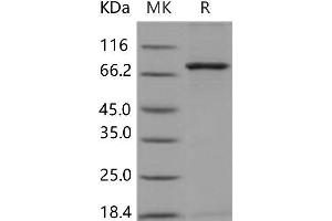 NEK3 Protein (GST tag,His tag)