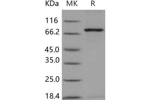 NEK3 Protein (GST tag,His tag)