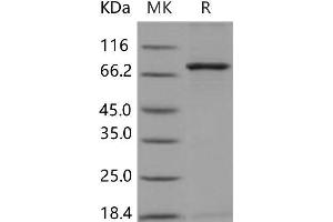 Western Blotting (WB) image for NIMA related kinase 3 (NEK3) (Active) protein (GST tag,His tag) (ABIN7320002) (NEK3 Protein (GST tag,His tag))