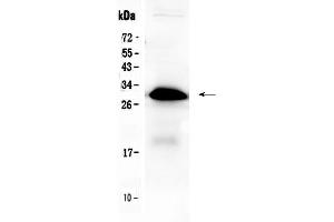 Western blot analysis of IGFBP1 using anti-IGFBP1 antibody . (IGFBPI 抗体  (AA 69-259))