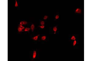 ABIN6266856 staining MCF-7 cells by IF/ICC.