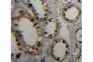 IHC-P analysis of Kidney tissue, with DAB staining. (PTPRB 抗体  (AA 1655-1918))