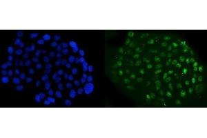 IF analysis of NFIB/NF1B2 using anti-NFIB/NF1B2 antibody (ABIN7602995).