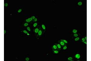 Immunofluorescence (IF) image for anti-Signal Transducer and Activator of Transcription 6, Interleukin-4 Induced (STAT6) (AA 1-319) antibody (ABIN7169690)