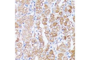 Immunohistochemistry of paraffin-embedded human stomach using SPON2 antibody (ABIN6129679, ABIN6148370, ABIN6148372 and ABIN6215647) at dilution of 1:100 (40x lens). (SPON2 抗体  (AA 27-150))