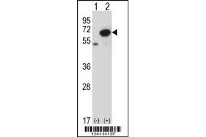 Western blot analysis of PNKP using rabbit polyclonal PNKP Antibody using 293 cell lysates (2 ug/lane) either nontransfected (Lane 1) or transiently transfected (Lane 2) with the PNKP gene. (PNKP 抗体  (N-Term))