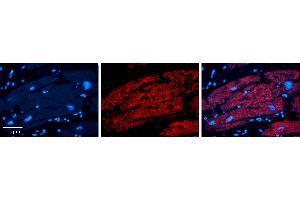 Rabbit Anti-IRF1 Antibody Catalog Number: ARP31296_P050 Formalin Fixed Paraffin Embedded Tissue: Human heart Tissue Observed Staining: Cytoplasmic Primary Antibody Concentration: 1:100 Other Working Concentrations: 1:600 Secondary Antibody: Donkey anti-Rabbit-Cy3 Secondary Antibody Concentration: 1:200 Magnification: 20X Exposure Time: 0. (IRF1 抗体  (N-Term))