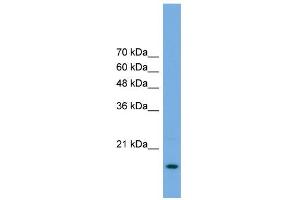 Western Blotting (WB) image for anti-Processing of Precursor 5, Ribonuclease P/MRP Subunit (POP5) (Middle Region) antibody (ABIN2786894)
