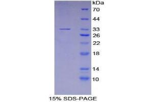 SDS-PAGE analysis of Human P2RY14 Protein. (P2RY14 蛋白)